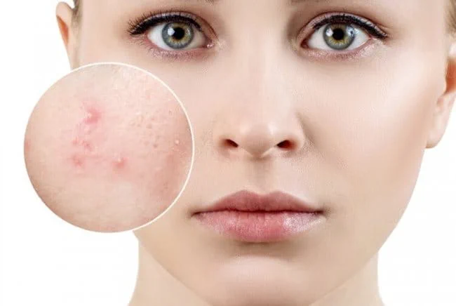 nhung-mon-an-gay-mun-trung-ca-1