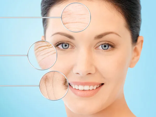 vi-sao-da-bi-lao-hoa-4